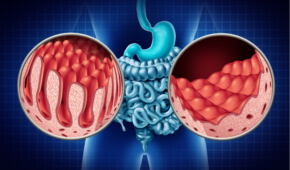 Iridology page leaky gut image