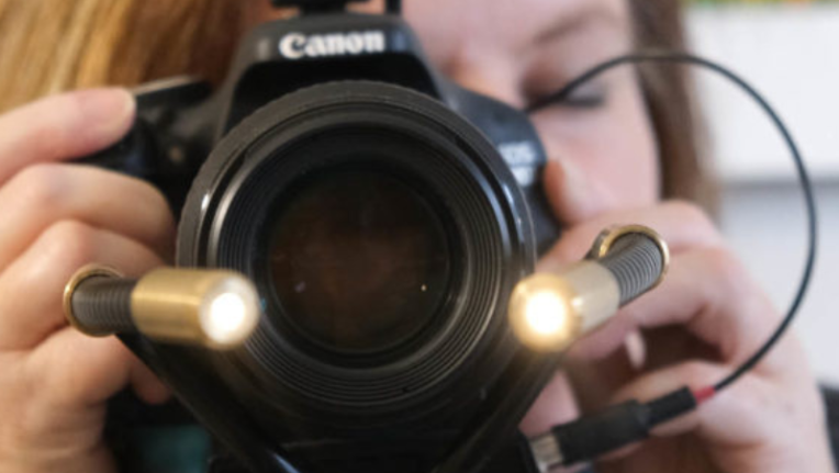 Iridology page service image 1